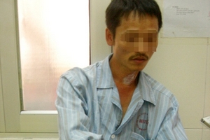 Hà Nội: Nhiều người nhập viện vì bị chuột cắn