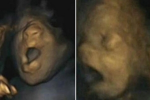 Con người biết ngáp từ trong bụng mẹ