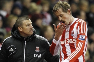 “Sếu vườn” Crouch mất... răng vì bóng bổng