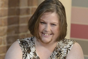 Người phụ nữ mọc râu như đàn ông