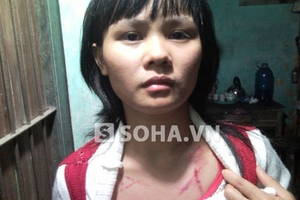 Chồng úp chậu phân, vùi đầu vợ vào nước nóng