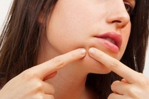 Smartphone phát hiện mụn trước khi “mọc”