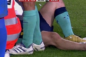 Sau gần 2 năm, Messi mới dính chấn thương