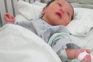 Phía sau hành động mẹ cắn đứt ngón tay con mới sinh