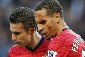 FA vào cuộc điều tra vụ Ferdinand đổ máu bởi CĐV Man City