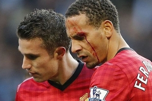 Rio suýt bị mù, cả nhà Ashley Cole hả hê ăn mừng