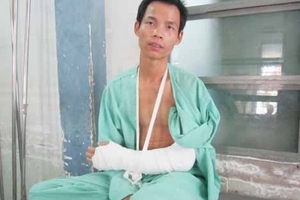 Nạn nhân kể lại giây phút bị cướp chặt tay, cướp iPhone dởm