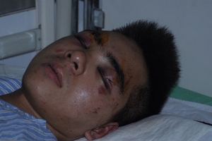 Vụ 'chào phòng' KTX đẫm máu: Trường định ém thông tin