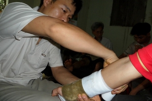 “Kỳ nhân” nối xương và bài thuốc chữa gãy xương bí truyền