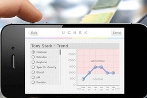 Xét nghiệm nước tiểu bằng ứng dụng smartphone