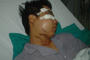 Tạm đình chỉ tổ công tác Y5/141 để phục vụ công tác điều tra