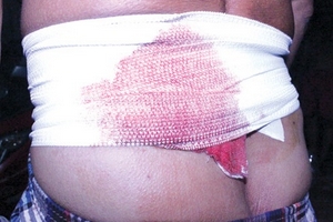 Phó chánh Thanh tra quận 9 bị tố chém người