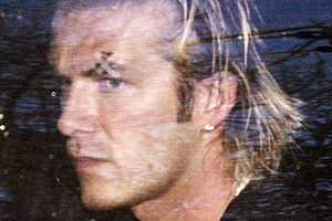 Nạn nhân "chiếc giầy bay" Beckham tri ân Sir Alex