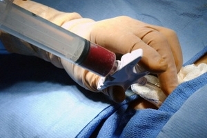 Thực hiện thành công ca ghép tế bào gốc tạo máu