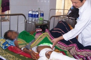 Giải trình thông tin “vi khuẩn ăn thịt người” ở Kon Tum