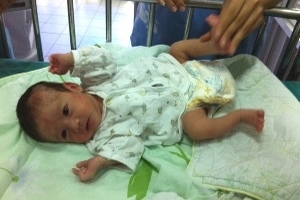 Cứu sống bé trai trong bụng thai phụ hôn mê 3 tháng