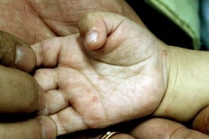 Bính Phước: Bé 2 tuổi tử vong vì bệnh tay chân miệng