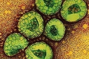 Virus MERS-CoV ít có khả năng lây lan thành dịch