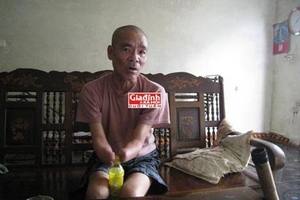 Chuyện tình kỳ lạ và ước mơ hiến mắt đổi… một bản nhạc của người đàn ông cụt hai tay