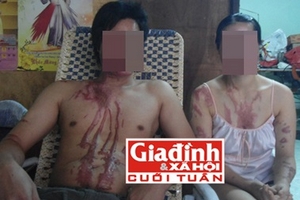 Ca hóa chất xé nát giấc mơ lập nghiệp của đôi vợ chồng nghèo