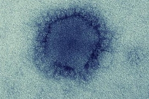 Virus gây bệnh MERS từng lây từ động vật sang người