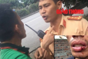 CSGT Hải Dương đánh rách môi người vi phạm