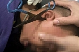 Nghe tiếng kêu khóc, người mẹ hoảng hốt phát hiện con trai 3 tuổi bị kéo đâm thấu tai