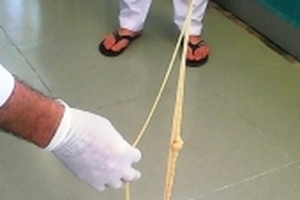 Lấy con sán dài hơn 10m làm ổ trong bụng bệnh nhân nữ