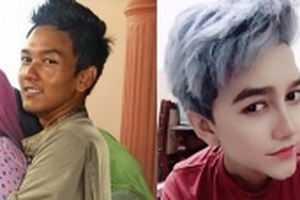 Chàng trai gọt cằm, cắt mí để giống nhân vật hoạt hình Nhật