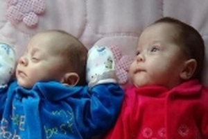 Cặp song sinh chào đời kỳ diệu từ người mẹ chết não