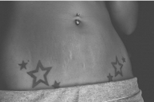 Vết rạn da thần thánh (!)