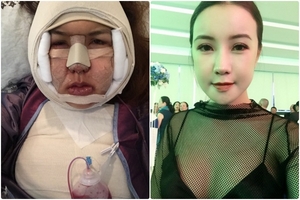 Quá trình dao kéo 7 bộ phận với 12 ca phẫu thuật của cô gái 9X để ‘xinh như mộng’