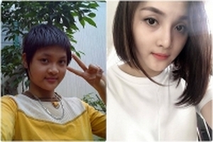 Từng mài mặt xuống đất vì 2 vụ tai nạn, cô gái lột xác thành hot girl sau khi dao kéo và giảm cân