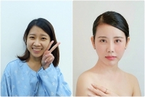 Cô gái phẫu thuật thẩm mỹ thành công: Là phụ nữ sao không yêu cái đẹp?