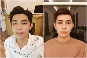Chàng trai 9X đẹp như diễn viên nhờ 'đập đi xây lại' với chi phí 500 triệu đồng