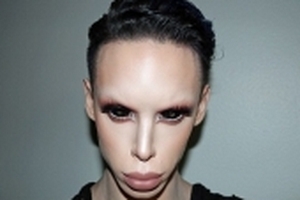 Những ca phẫu thuật thẩm mỹ cười ra nước mắt