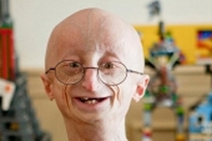 Những đứa trẻ kỳ lạ nhưng có thật