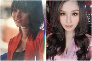 Cô gái 8X phải trả giá về hậu quả của việc phẫu thuật thẩm mỹ vì… nghiện làm đẹp