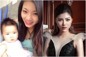 Cô gái 9X quyết định dao kéo vì phương châm: Nhan sắc là một phần của hạnh phúc