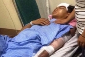 Truy tìm tài xế cán nát tay bí thư đoàn rồi bỏ trốn