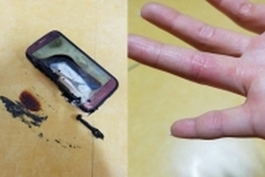 Galaxy S7 bất ngờ phát nổ gây bỏng tay người dùng