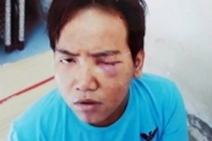 Bảo vệ dân phố sát hại bé trai 6 tuổi ở Sài Gòn bị tâm thần phân liệt