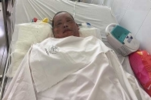 Vụ nổ hầm cầu: cả gia đình nghèo bỏng nặng