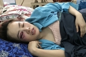 Cha thanh niên đánh cô gái gãy răng, thâm tím mặt ở quán bánh xèo xin lỗi thay con