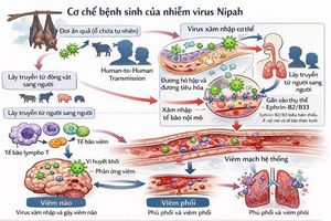 Bệnh do vi rút Nipah: Nhận diện đúng để phòng ngừa hiệu quả