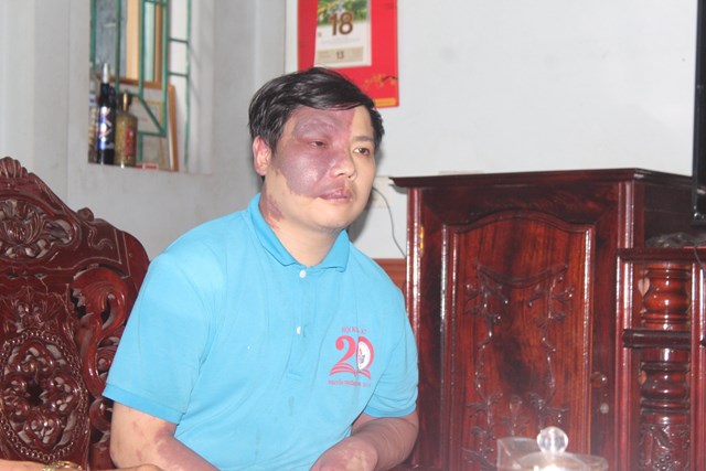 Con trai ông Phạm Ngọc Hậu – nạn nhân chất độc da cam, mang di chứng từ cha.