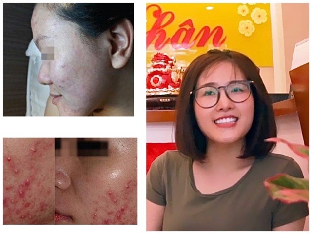 Ngọc Mai_ 24 tuổi, nhân viên văn phòng