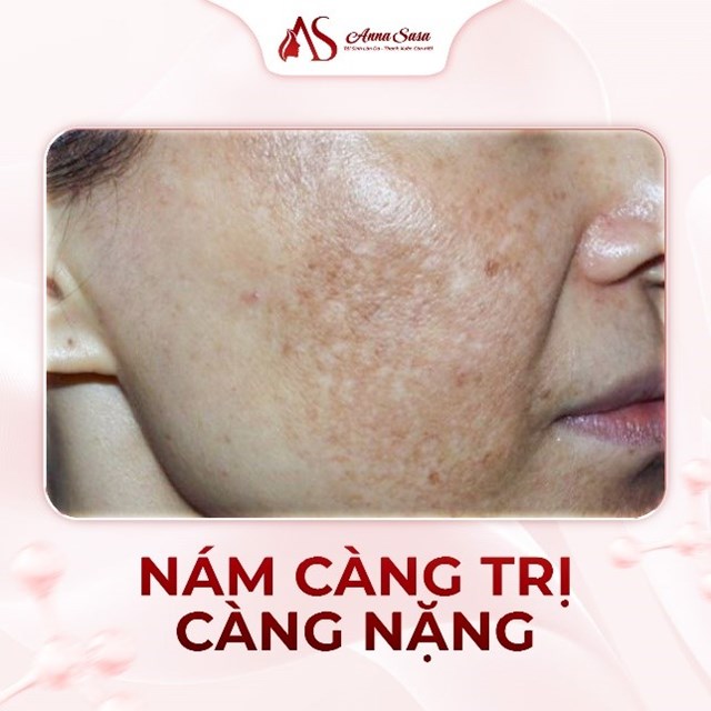 Làn da vào Xuân, năm mới thêm phơi phới - Ảnh 2